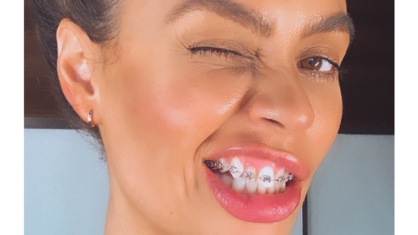 Как внешность и здоровье зависят от состояния зубов