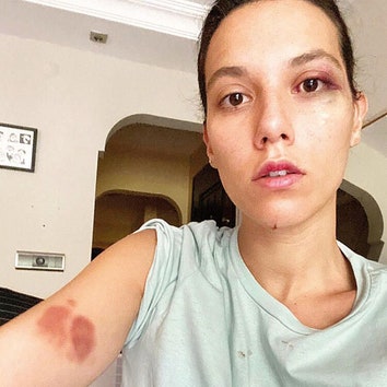 Турецкому актеру из сериала «Великолепный век» грозит 13 лет тюрьмы за домашнее насилие