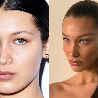 Brow Lift &- почему Белла Хадид, Кендалл Дженнер и другие звезды сделали эту операцию