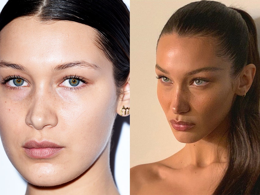 Brow Lift &- почему Белла Хадид, Кендалл Дженнер и другие звезды сделали эту операцию