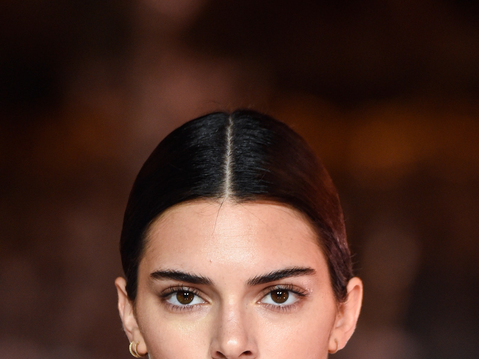 Brow Lift &- почему Белла Хадид, Кендалл Дженнер и другие звезды сделали эту операцию