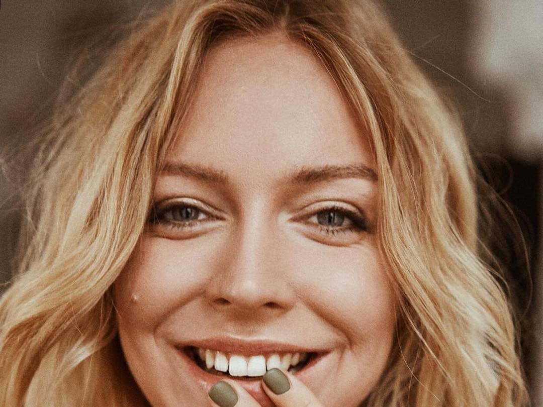 Редактор Glamour откровенно рассказала о борьбе с проблемной кожей