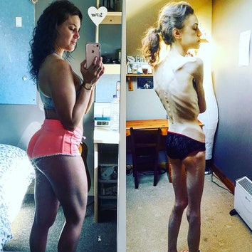 «Instagram помог мне победить анорексию»: фитнес-блогер рассказала о борьбе с пищевым расстройством