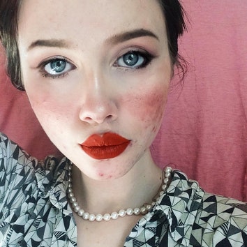 «Мне надоело скрывать, что у меня есть акне»: бьюти-блогер с проблемной кожей показала свое лицо без макияжа