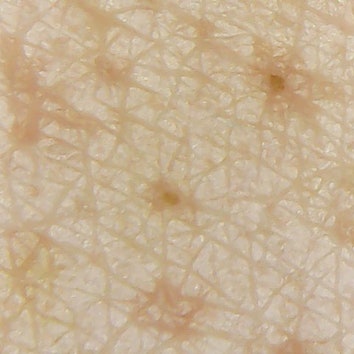 Как выглядит наша кожа под микроскопом до и после использования маски