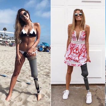 Потерявшая ногу бразильская модель покорила Instagram