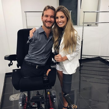 Потерявшая ногу бразильская модель покорила Instagram