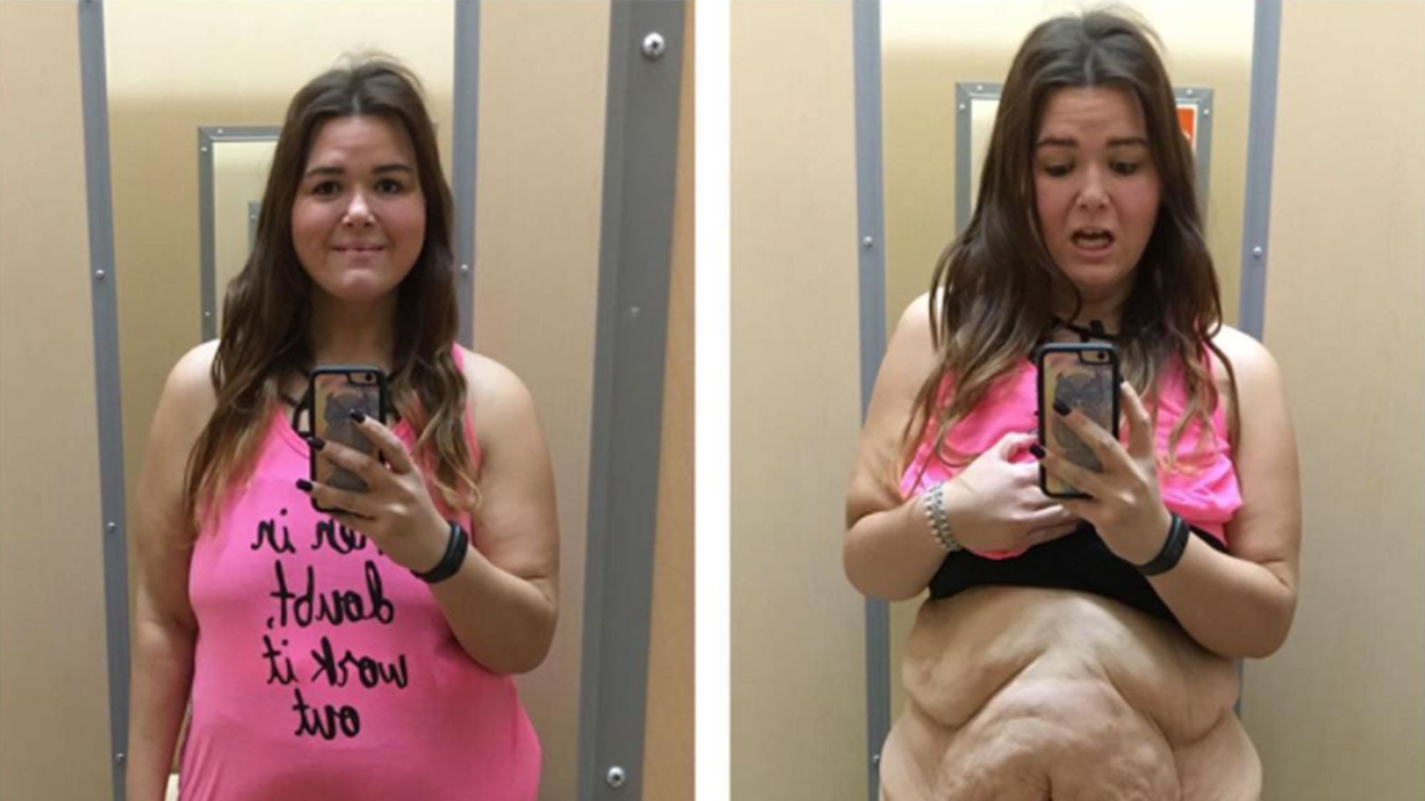Джессика Вебер сбросившая 90 кг делится фото историей похудения и проблемой излишков кожи | Glamour