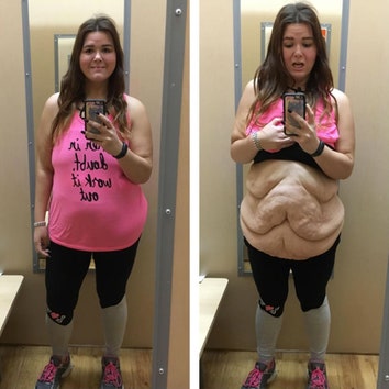 Девушка, похудевшая на 90 кг, откровенно рассказала, через что ей пришлось пройти