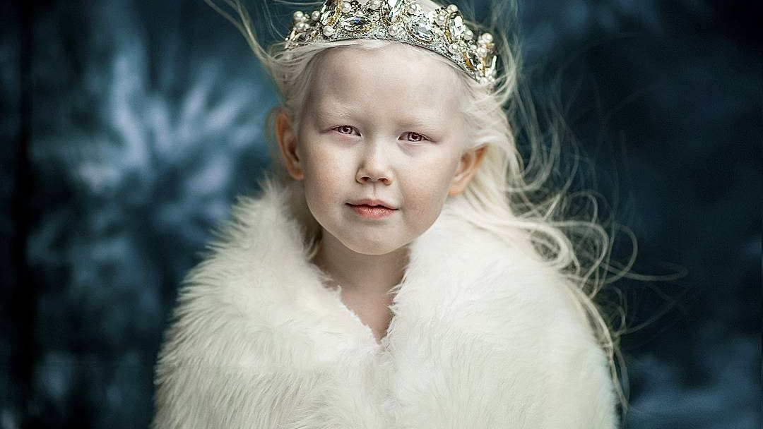 Девочкаальбинос из Якутии стала звездой Инстаграма фото восьмилетней Нарияны | Glamour