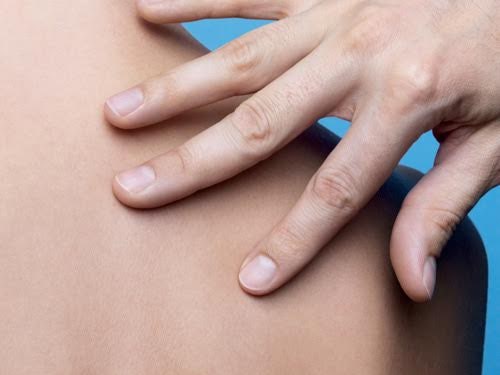 #защитисвоюкожу: День диагностики меланомы La Roche-Posay
