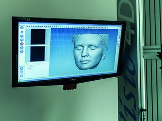 Система AEVAHE позволяет получить 3Dизображение лица или всего тела. Затем врач оценивает например рельеф кожи лица...
