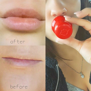 Прибор Fullips.