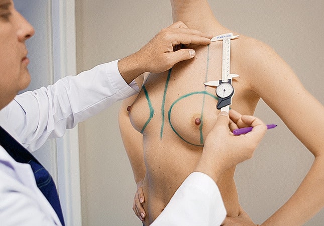 Стала совсем большая история одной операции по увеличению груди