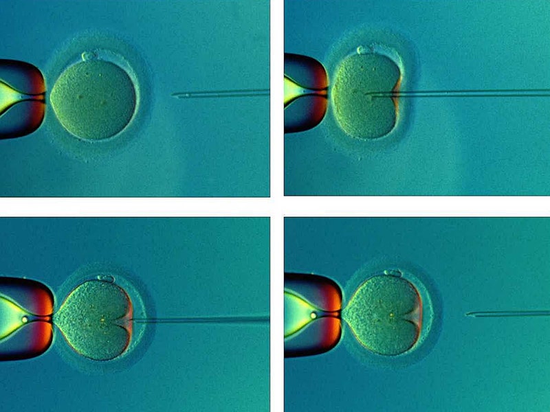 Процесс оплодотворения яйцеклетки с помощью ЭКО
