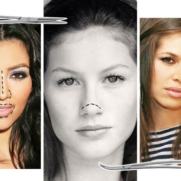 Не родись красивой: знаменитые красавицы до и после пластической хирургии