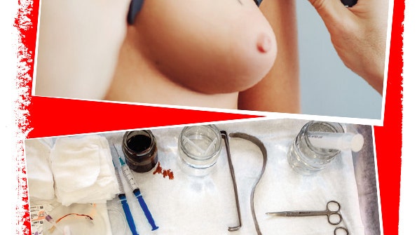 Маммопластика как делают операцию по увеличению груди | Allure