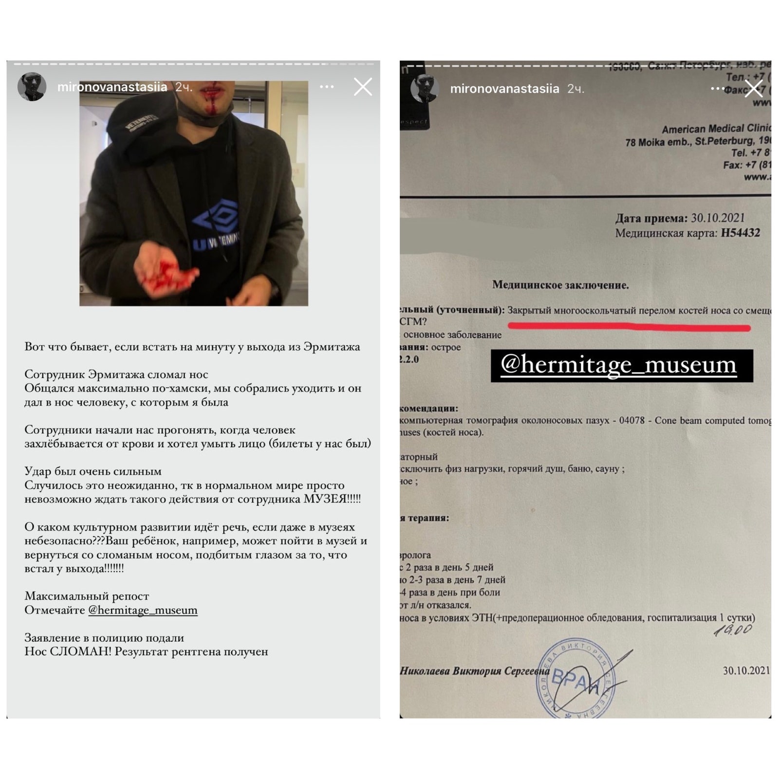 Охранник Эрмитажа сломал нос посетителю пока тот искал QRкод